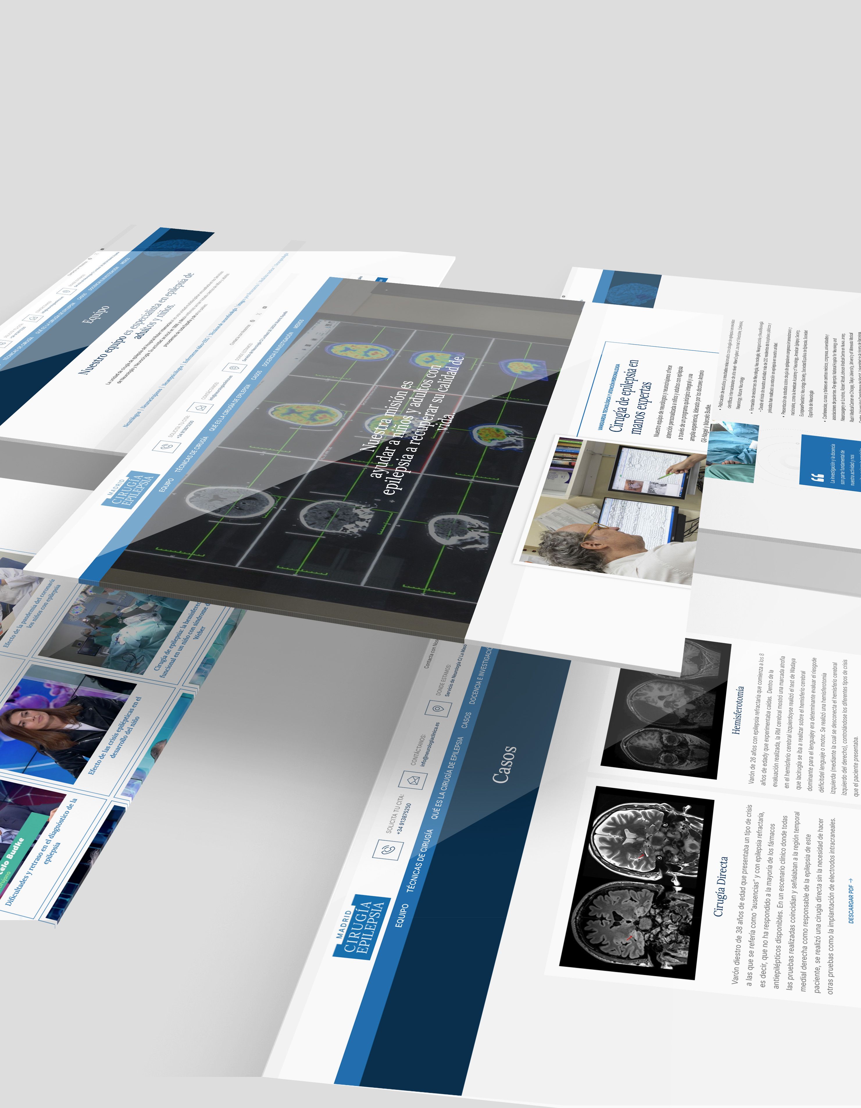 accionlab-proyecto-web-cirugia-epilepsia-1