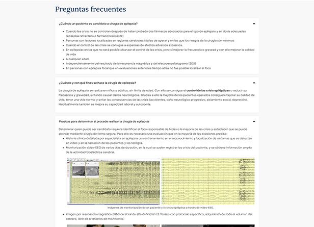 accionlab-web-cirugia-epilepsia-2