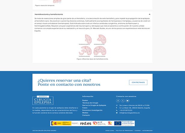 accionlab-web-cirugia-epilepsia-4